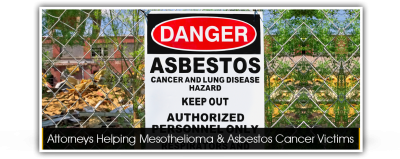 Mesothelioma Attorneys